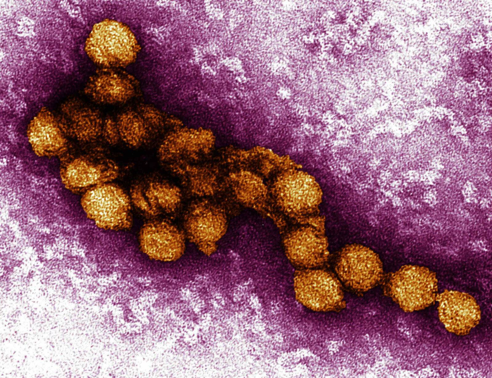 West nile agosto 2022